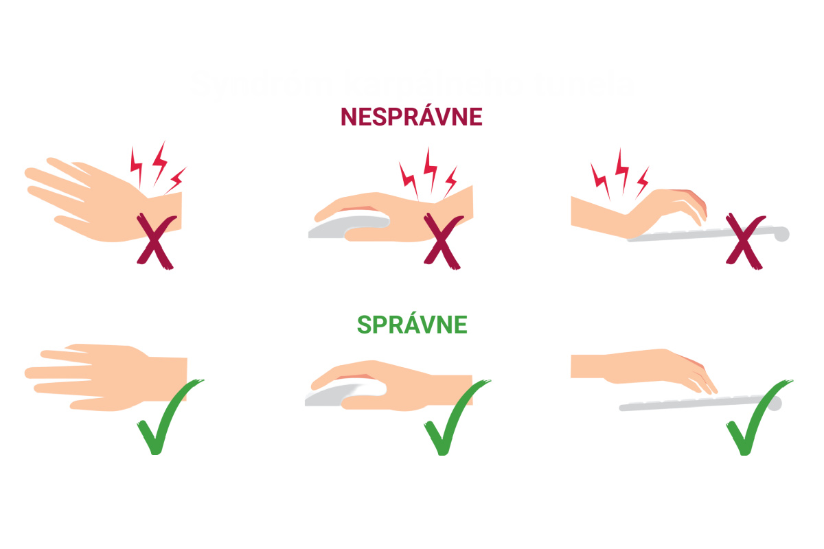 Poloha rúk pri práci s myšou a klávesnicou – msg life Slovakia Die Handhaltung ist bei der Arbeit mit dem PC wichtig